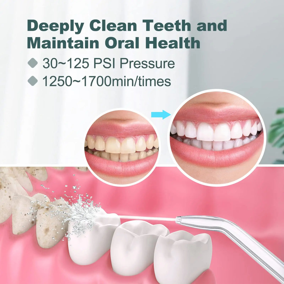 Water Flosser for Teeth and Braces Cleaning, Oral Irrigator